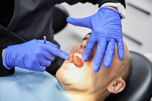 Best Emergency Denture Repair in Cresaptown, MD
